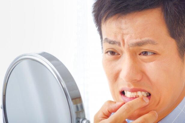 インプラントが気になる
